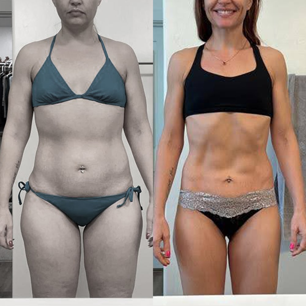 www tirzepatide How the weight loss drug tirzepatide is also helping heart failure patients www tirzepatide How the weight loss drug tirzepatide is also helping heart failure patients