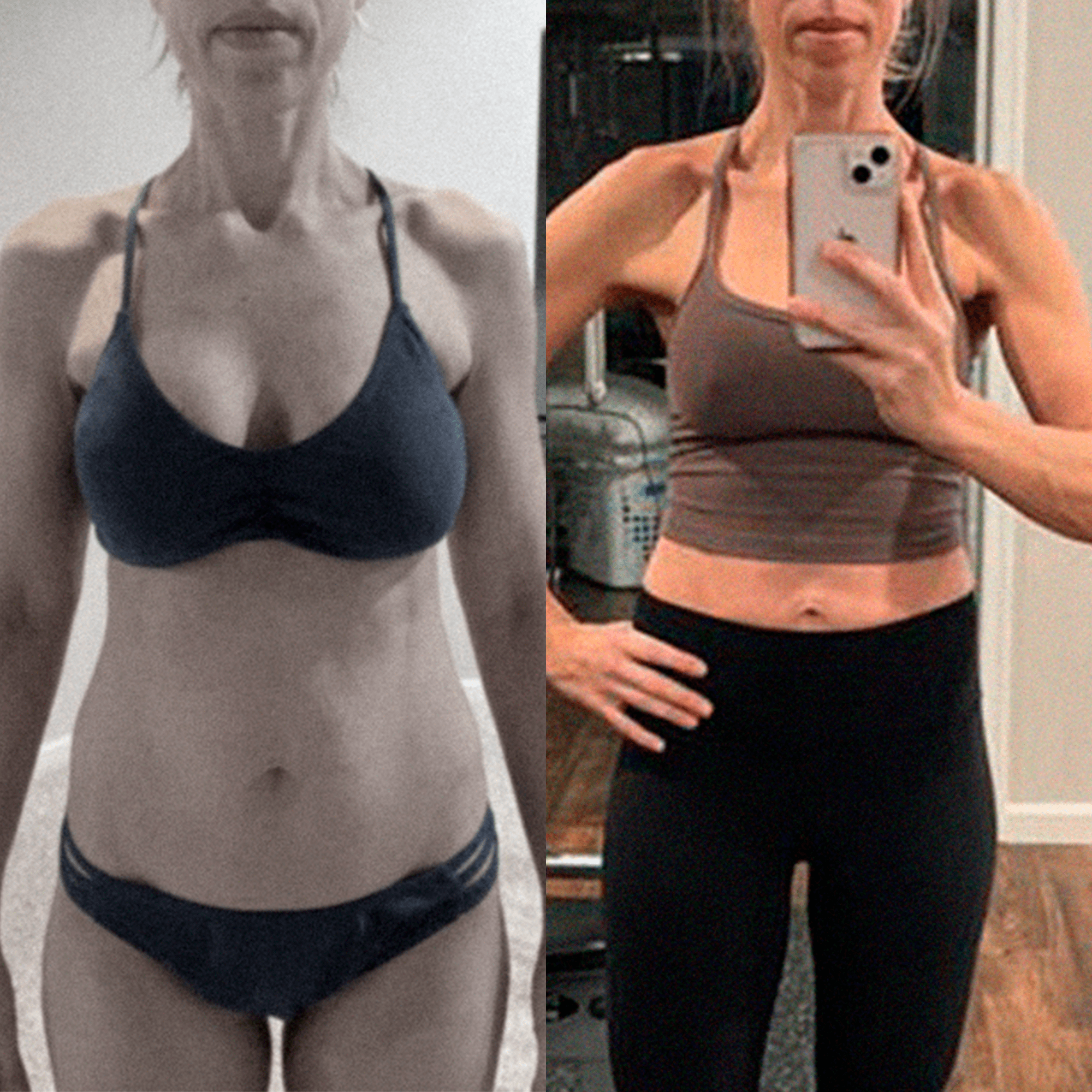 tirzepatide and allodynia Ozempic-like drugs may cause skin pain, says weight loss doctor tirzepatide and allodynia Ozempic-like drugs may cause skin pain, says weight loss doctor