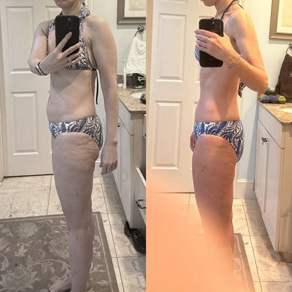can i quit tirzepatide cold turkey Happy Weight Loss Wednesday! 💪🏽🌿✨Curious what happens if you stop Semaglutide and Tirzepatide injections cold turkey? Dr. Waltzman has the answers you need as we explore maintaining progress after can i quit tirzepatide cold turkey Happy Weight Loss Wednesday! 💪🏽🌿✨Curious what happens if you stop Semaglutide and Tirzepatide injections cold turkey? Dr. Waltzman has the answers you need as we explore maintaining progress after